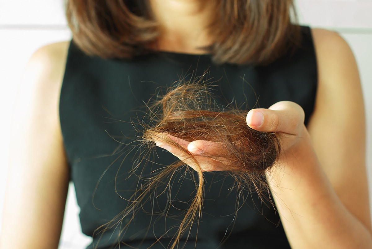 Hairloss Treatment Bournemouth